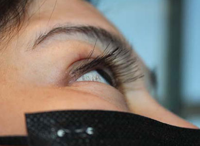 Eyelash Transplant Procedure After Result 3