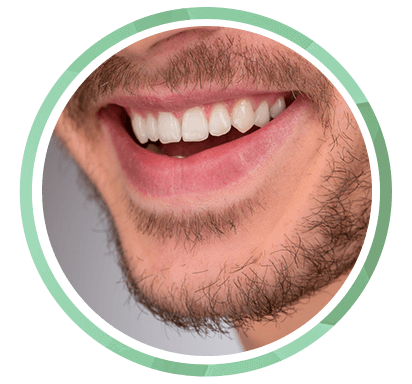 Manzanares Hair - Facial Hair Transplant Services