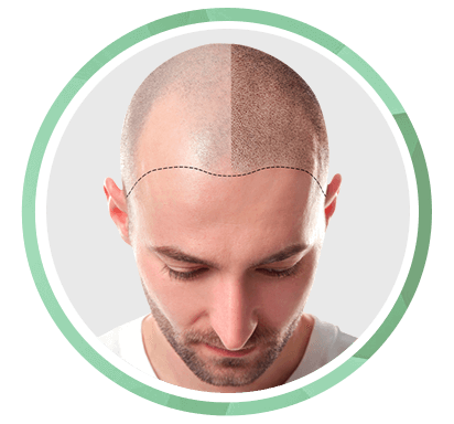 Top 10 Hair Transplant Clinics in India - MouthShut.com